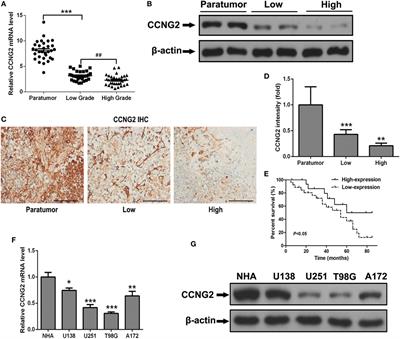CCNG2 Overexpression Mediated by AKT Inhibits Tumor Cell Proliferation in Human Astrocytoma Cells